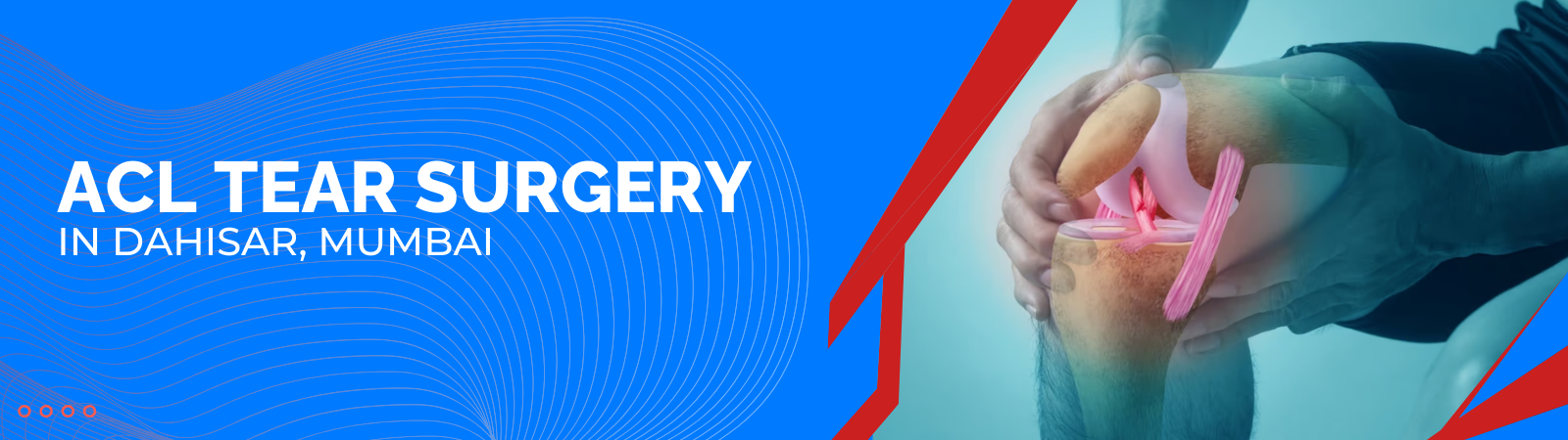 Acl_tear_surgery_in_Dahisar_Mumbai