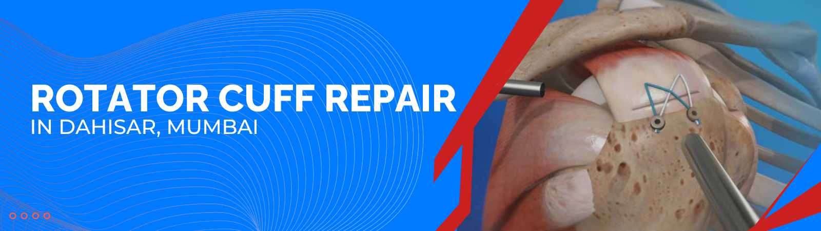 Rotator Cuff Repair in Dahisar, Mumbai Rotator Cuff Repair in Dahisar, Mumbai