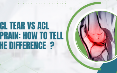 ACL Tear vs ACL Sprain: How to Tell the Difference?