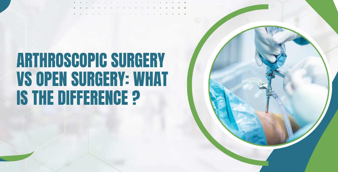 Arthroscopic Surgery vs Open Surgery: What Is the Difference?