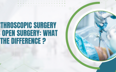 Arthroscopic Surgery vs Open Surgery: What Is the Difference?