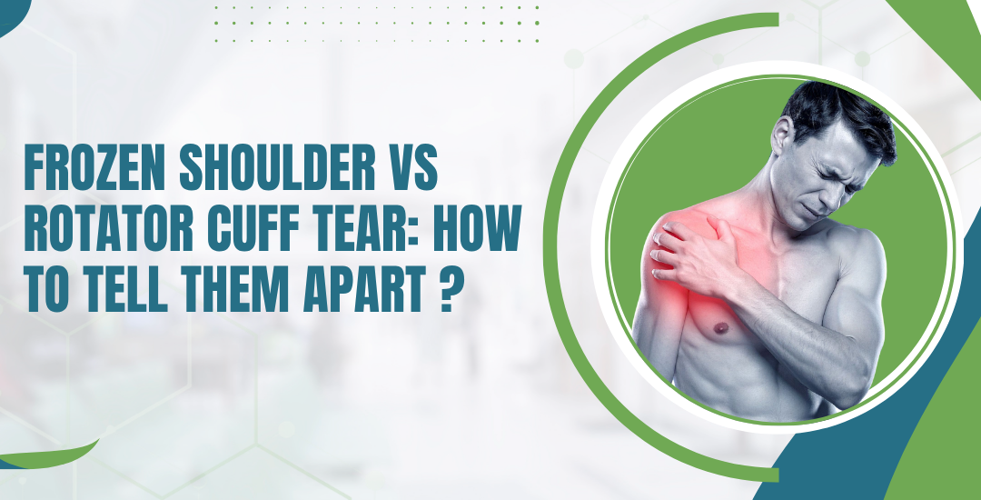 Frozen Shoulder vs Rotator Cuff Tear: How to Tell Them Apart