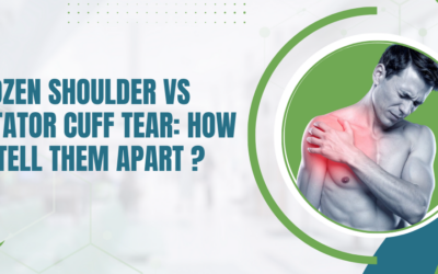 Frozen Shoulder vs Rotator Cuff Tear: How to Tell Them Apart