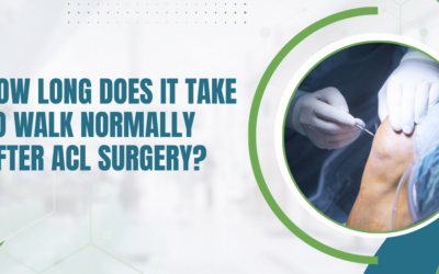 How Long Does It Take to Walk Normally After ACL Surgery?