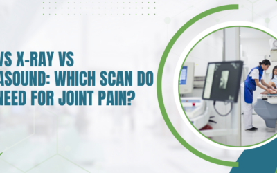 MRI vs X-Ray vs Ultrasound: Which Scan Do You Need for Joint Pain?