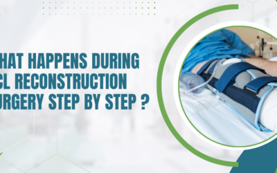 What Happens During ACL Reconstruction Surgery Step by Step?