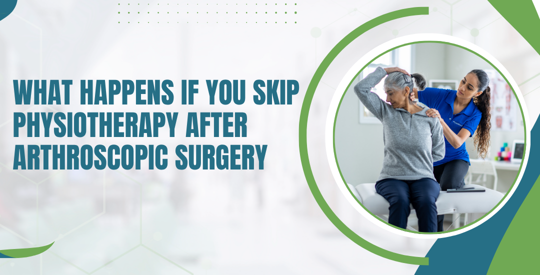 What Happens If You Skip Physiotherapy After Arthroscopic Surgery?