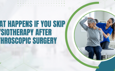 What Happens If You Skip Physiotherapy After Arthroscopic Surgery?