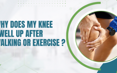 Why Does My Knee Swell Up After Walking or Exercise?