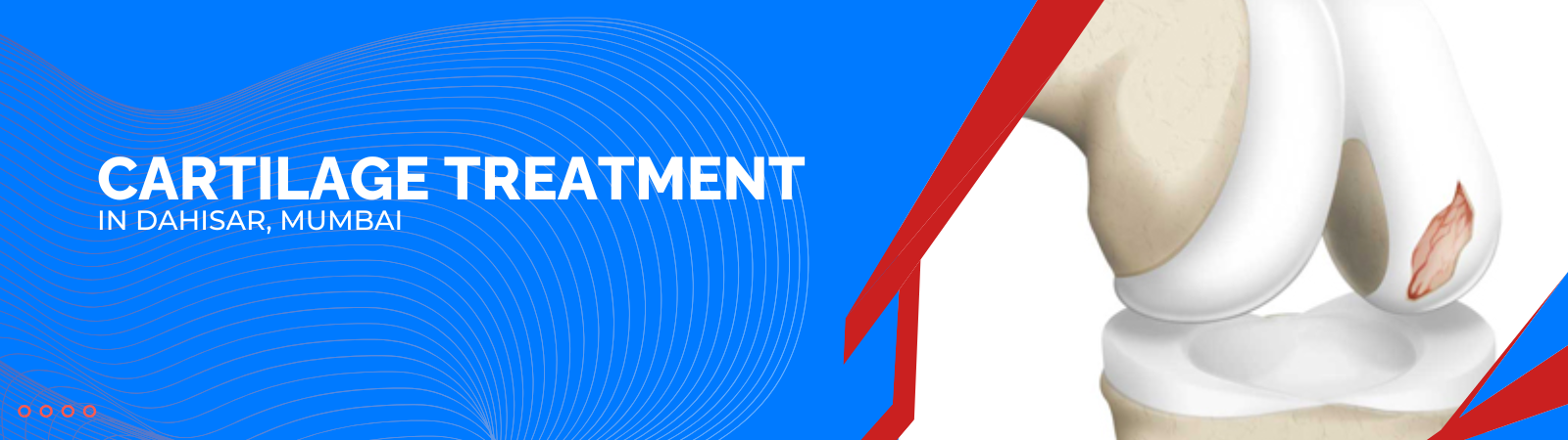 Meniscus Tear Treatment in Dahisar, Mumbai