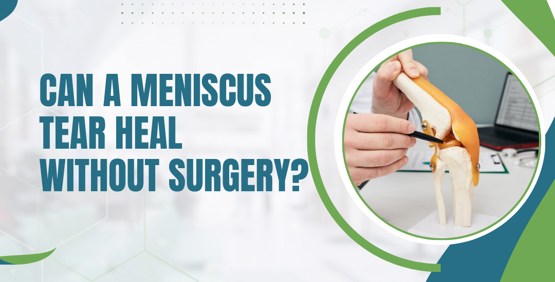 Can a Meniscus Tear Heal Without Surgery