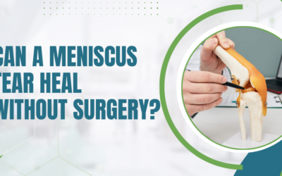 Can a Meniscus Tear Heal Without Surgery?
