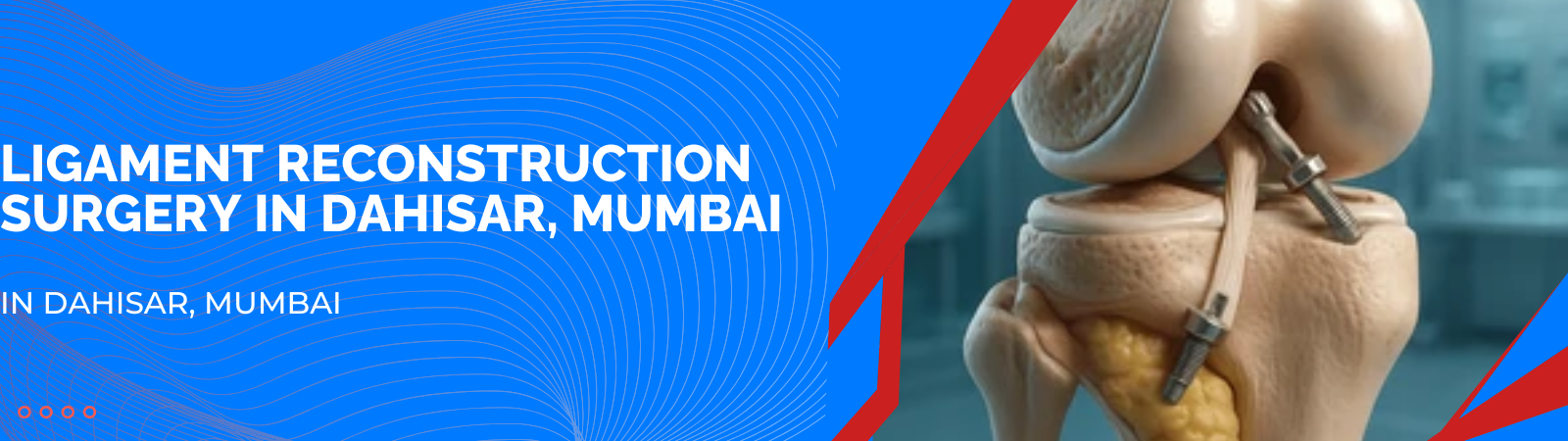 Banner advertising ligament reconstruction surgery in Dahisar, Mumbai, with blue abstract lines and a medical knee joint model on the right.